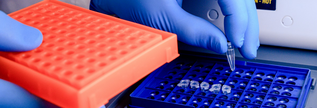 Cover Image: Viral RNA Isolation Methods Reviewed: Spin vs. Magnetic