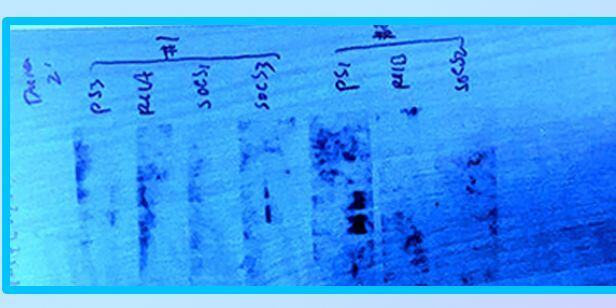 Difficult-To-Express Proteins Are Not Going to Solve Themselves
